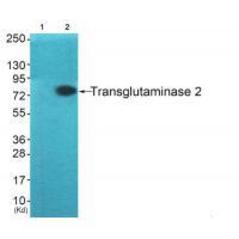 Western blot - Transglutaminase 2 Antibody from Signalway Antibody (33505) - Antibodies.com