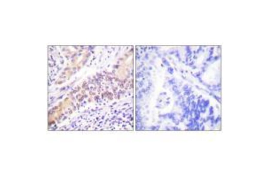 Immunohistochemistry - Topoisomerase II β Antibody from Signalway Antibody (33528) - Antibodies.com