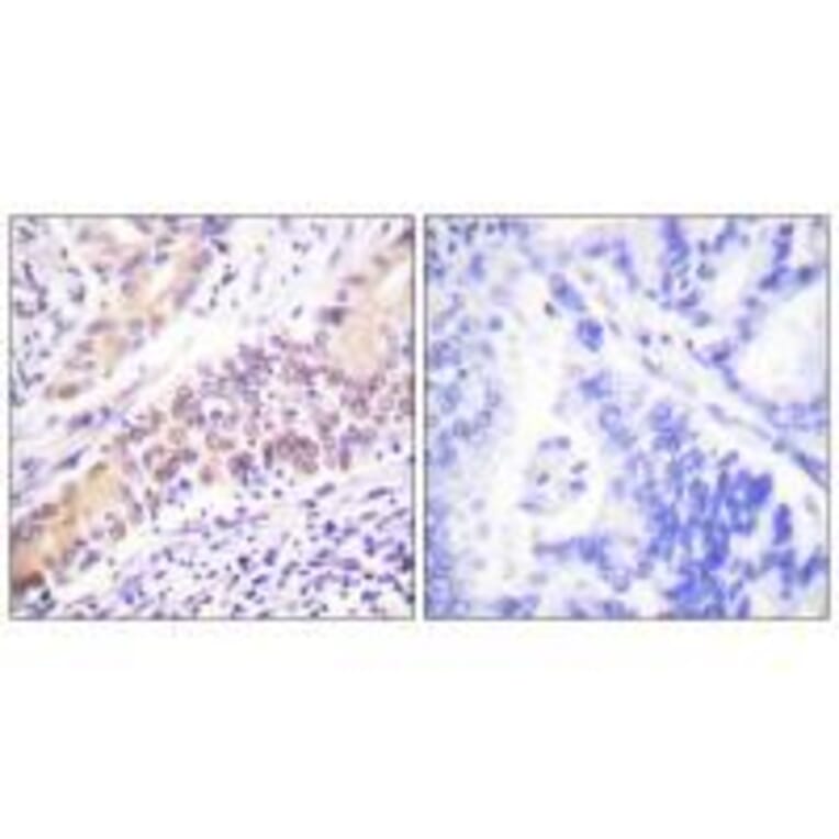 Immunohistochemistry - Topoisomerase II β Antibody from Signalway Antibody (33528) - Antibodies.com