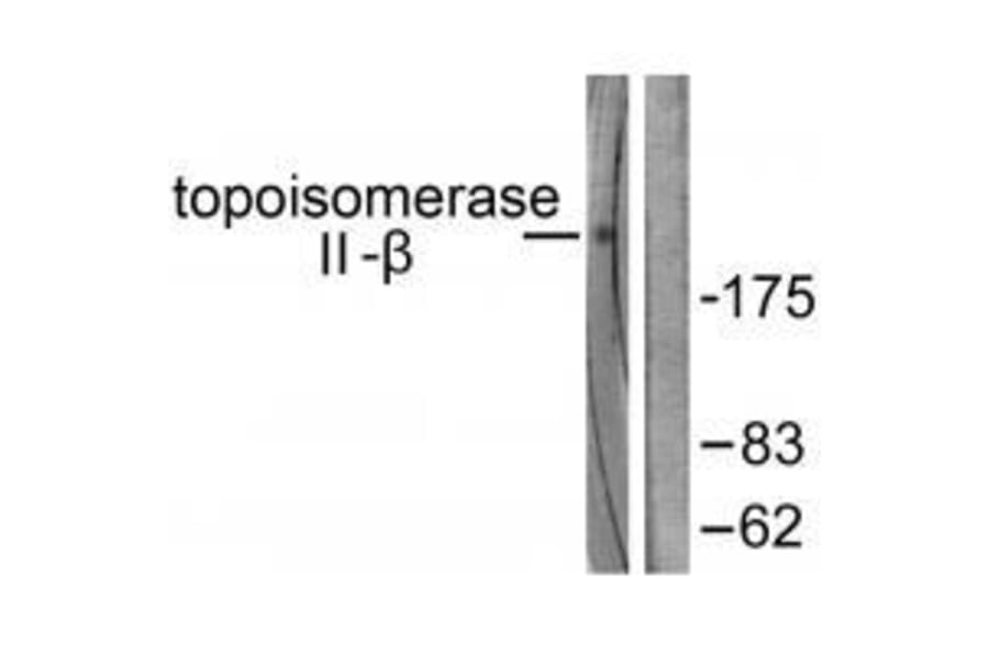 Western blot - Topoisomerase II β Antibody from Signalway Antibody (33528) - Antibodies.com