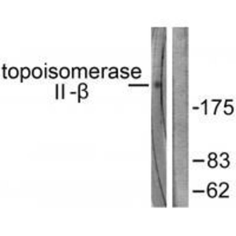 Western blot - Topoisomerase II β Antibody from Signalway Antibody (33528) - Antibodies.com