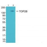 Western blot - Topoisomerase II β Antibody from Signalway Antibody (33528) - Antibodies.com