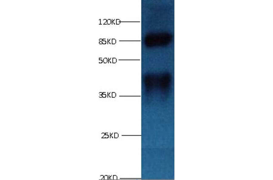 LP-PLA2 Monoclonal Antibody from Signalway Antibody (42042) - Antibodies.com