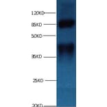 LP-PLA2 Monoclonal Antibody from Signalway Antibody (42042) - Antibodies.com