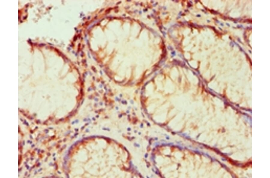 Immunohistochemistry - LP-PLA2 Monoclonal Antibody from Signalway Antibody (42042) - Antibodies.com