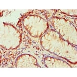 Immunohistochemistry - LP-PLA2 Monoclonal Antibody from Signalway Antibody (42042) - Antibodies.com