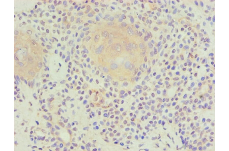 Immunohistochemistry - LP-PLA2 Monoclonal Antibody from Signalway Antibody (42042) - Antibodies.com