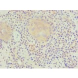 Immunohistochemistry - LP-PLA2 Monoclonal Antibody from Signalway Antibody (42042) - Antibodies.com