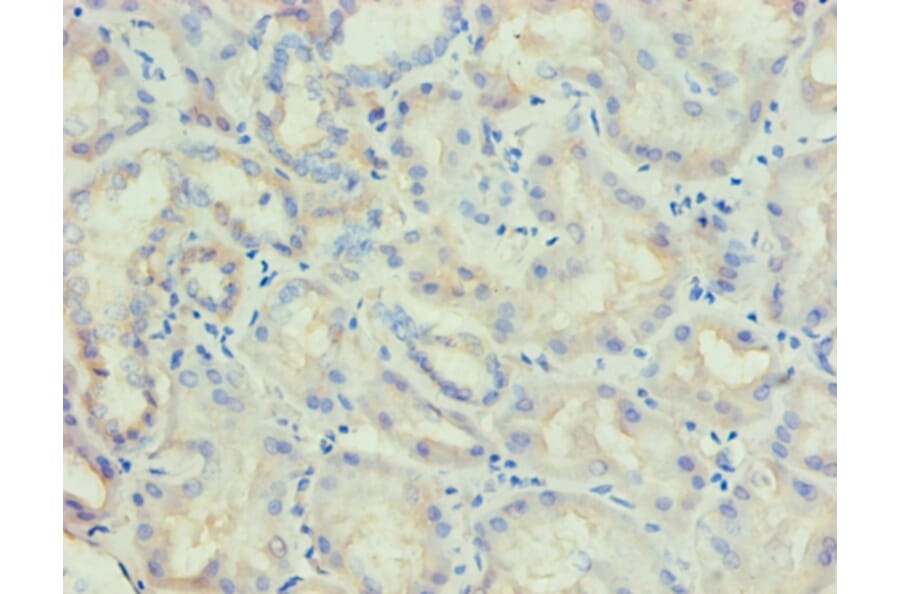 Immunohistochemistry - LP-PLA2 Monoclonal Antibody from Signalway Antibody (42042) - Antibodies.com