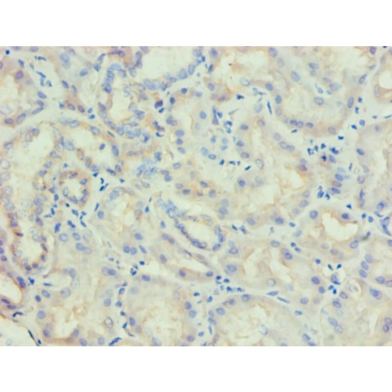 Immunohistochemistry - LP-PLA2 Monoclonal Antibody from Signalway Antibody (42042) - Antibodies.com