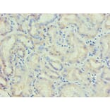 Immunohistochemistry - LP-PLA2 Monoclonal Antibody from Signalway Antibody (42042) - Antibodies.com