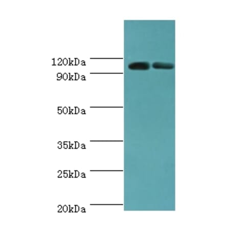 ALDH1L1 Polyclonal Antibody from Signalway Antibody (42061) - Antibodies.com