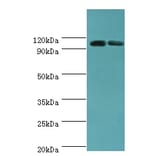 ALDH1L1 Polyclonal Antibody from Signalway Antibody (42061) - Antibodies.com