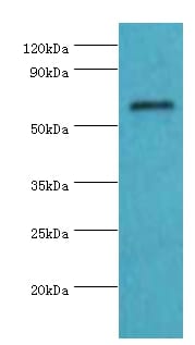 All lanes: Collagen alpha-1 (X) chain antibody at 4ug/ml+K562 whole cell lysate. Secondary Goat polyclonal to rabbit at 1/10000 dilution predicted band size: 66kDaobserved band size: 66kDa