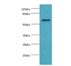 COL10A1 Polyclonal Antibody from Signalway Antibody (42129) - Antibodies.com