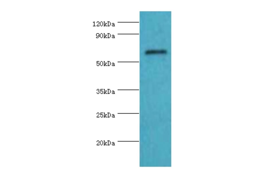 COL10A1 Polyclonal Antibody from Signalway Antibody (42129) - Antibodies.com