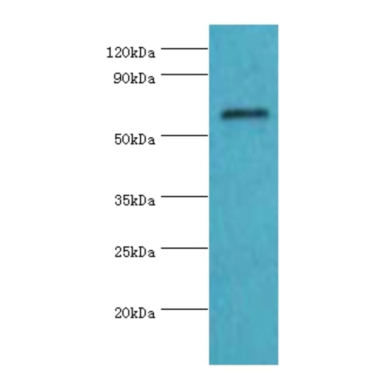 COL10A1 Polyclonal Antibody from Signalway Antibody (42129) - Antibodies.com