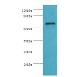 COL10A1 Polyclonal Antibody from Signalway Antibody (42129) - Antibodies.com