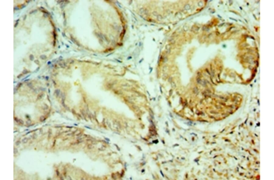 Immunohistochemistry - COL10A1 Polyclonal Antibody from Signalway Antibody (42129) - Antibodies.com