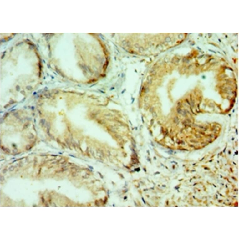 Immunohistochemistry - COL10A1 Polyclonal Antibody from Signalway Antibody (42129) - Antibodies.com