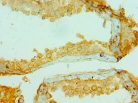 Immunohistochemical analysis of paraffin-embedded human testicle using #42129 at dilution of 1: 100.