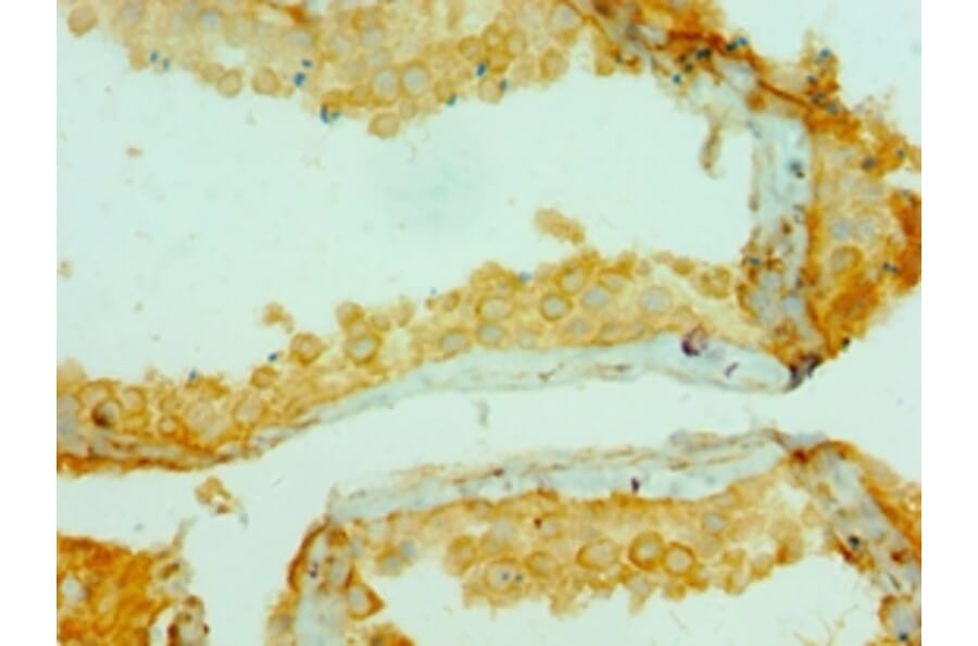 Immunohistochemistry - COL10A1 Polyclonal Antibody from Signalway Antibody (42129) - Antibodies.com