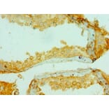 Immunohistochemistry - COL10A1 Polyclonal Antibody from Signalway Antibody (42129) - Antibodies.com