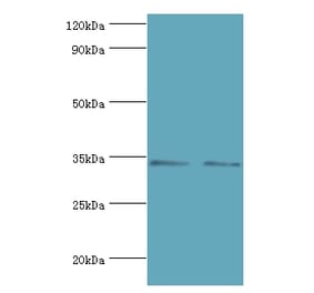 KIR2DS4 Polyclonal Antibody from Signalway Antibody (42230) - Antibodies.com