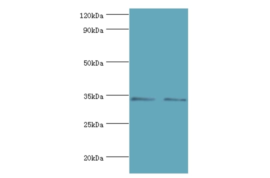 KIR2DS4 Polyclonal Antibody from Signalway Antibody (42230) - Antibodies.com