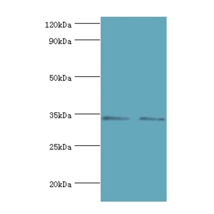 KIR2DS4 Polyclonal Antibody from Signalway Antibody (42230) - Antibodies.com