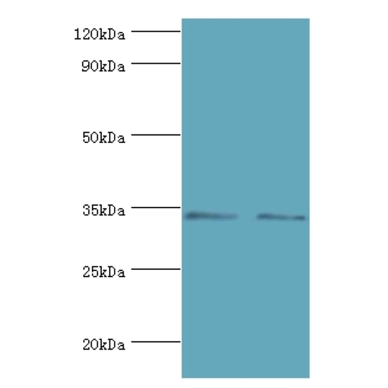 KIR2DS4 Polyclonal Antibody from Signalway Antibody (42230) - Antibodies.com
