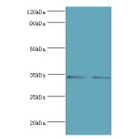 KIR2DS4 Polyclonal Antibody from Signalway Antibody (42230) - Antibodies.com