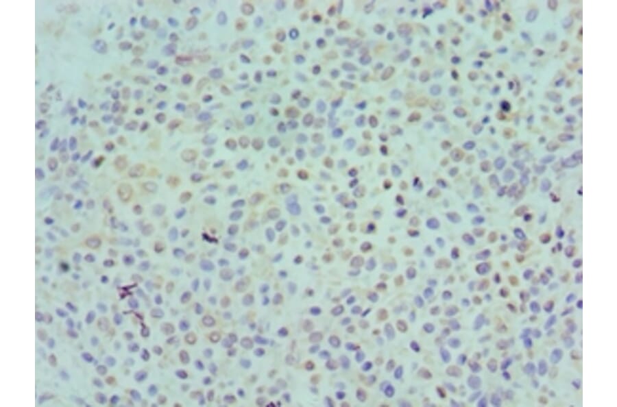 Immunohistochemistry - KIR2DS4 Polyclonal Antibody from Signalway Antibody (42230) - Antibodies.com
