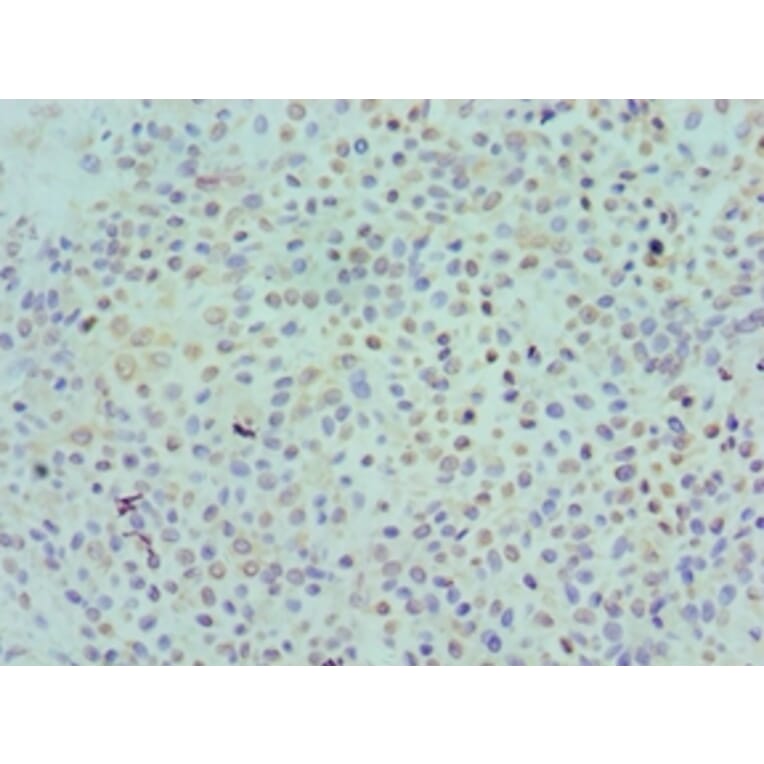 Immunohistochemistry - KIR2DS4 Polyclonal Antibody from Signalway Antibody (42230) - Antibodies.com