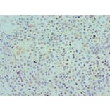 Immunohistochemistry - KIR2DS4 Polyclonal Antibody from Signalway Antibody (42230) - Antibodies.com
