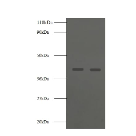 Basigin Polyclonal Antibody from Signalway Antibody (42549) - Antibodies.com