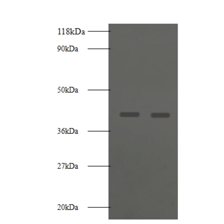 Basigin Polyclonal Antibody from Signalway Antibody (42549) - Antibodies.com