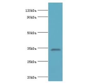 LDLRAP1 Polyclonal Antibody from Signalway Antibody (42658) - Antibodies.com