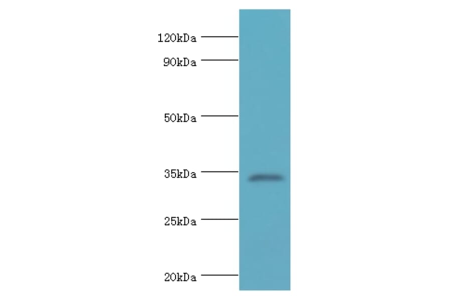LDLRAP1 Polyclonal Antibody from Signalway Antibody (42658) - Antibodies.com