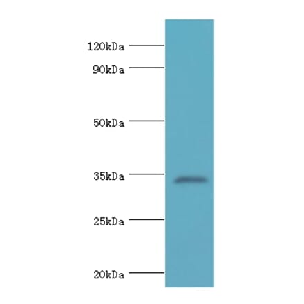 LDLRAP1 Polyclonal Antibody from Signalway Antibody (42658) - Antibodies.com