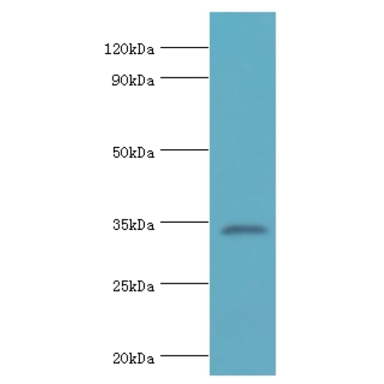 LDLRAP1 Polyclonal Antibody from Signalway Antibody (42658) - Antibodies.com