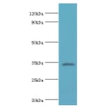 LDLRAP1 Polyclonal Antibody from Signalway Antibody (42658) - Antibodies.com