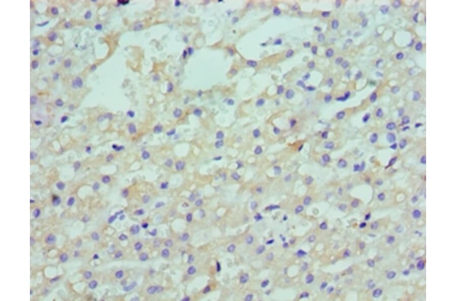 Immunohistochemistry - LDLRAP1 Polyclonal Antibody from Signalway Antibody (42658) - Antibodies.com