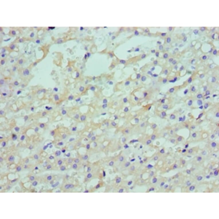 Immunohistochemistry - LDLRAP1 Polyclonal Antibody from Signalway Antibody (42658) - Antibodies.com