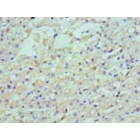 Immunohistochemistry - LDLRAP1 Polyclonal Antibody from Signalway Antibody (42658) - Antibodies.com