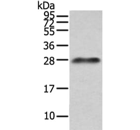 Lambda Light chain Antibody from Signalway Antibody (43108) - Antibodies.com