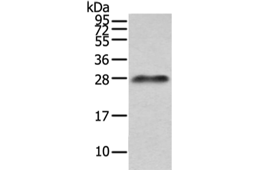 Lambda Light chain Antibody from Signalway Antibody (43108) - Antibodies.com