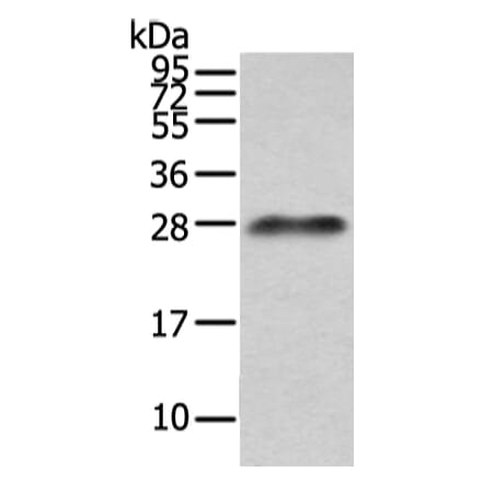 Lambda Light chain Antibody from Signalway Antibody (43108) - Antibodies.com