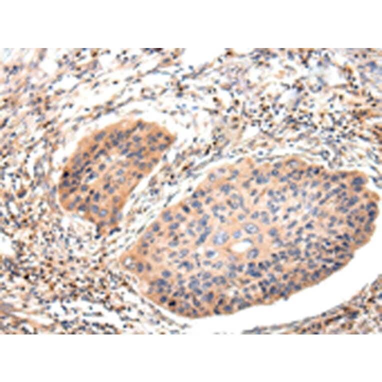 Immunohistochemistry - Lambda Light chain Antibody from Signalway Antibody (43108) - Antibodies.com