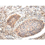 Immunohistochemistry - Lambda Light chain Antibody from Signalway Antibody (43108) - Antibodies.com